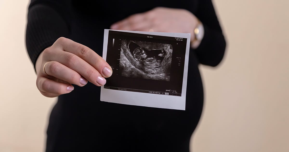 Compensation following misdiagnosis on antenatal scan