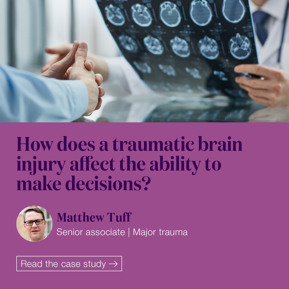 Mental capacity following a traumatic brain injury - Moore Barlow LLP